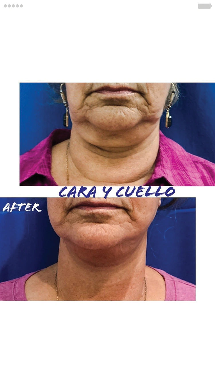 Cirugía de Cara y Cuello