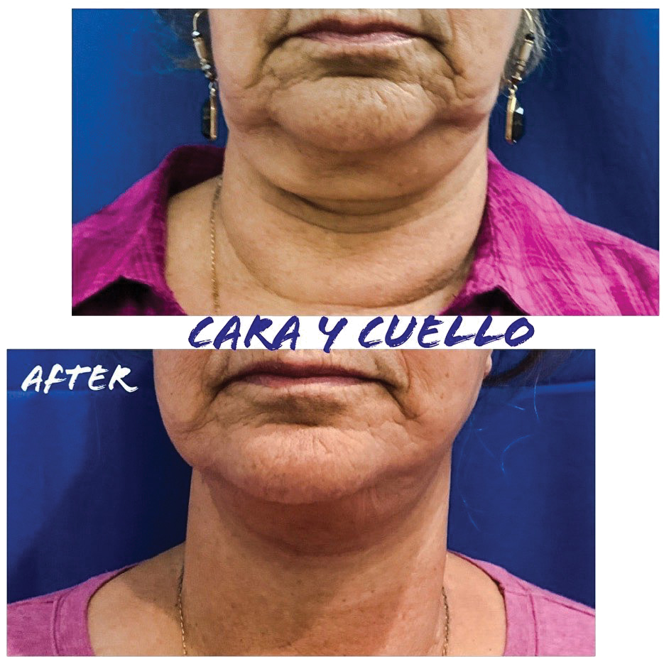 illustration suggesting the performance of facial surgeries