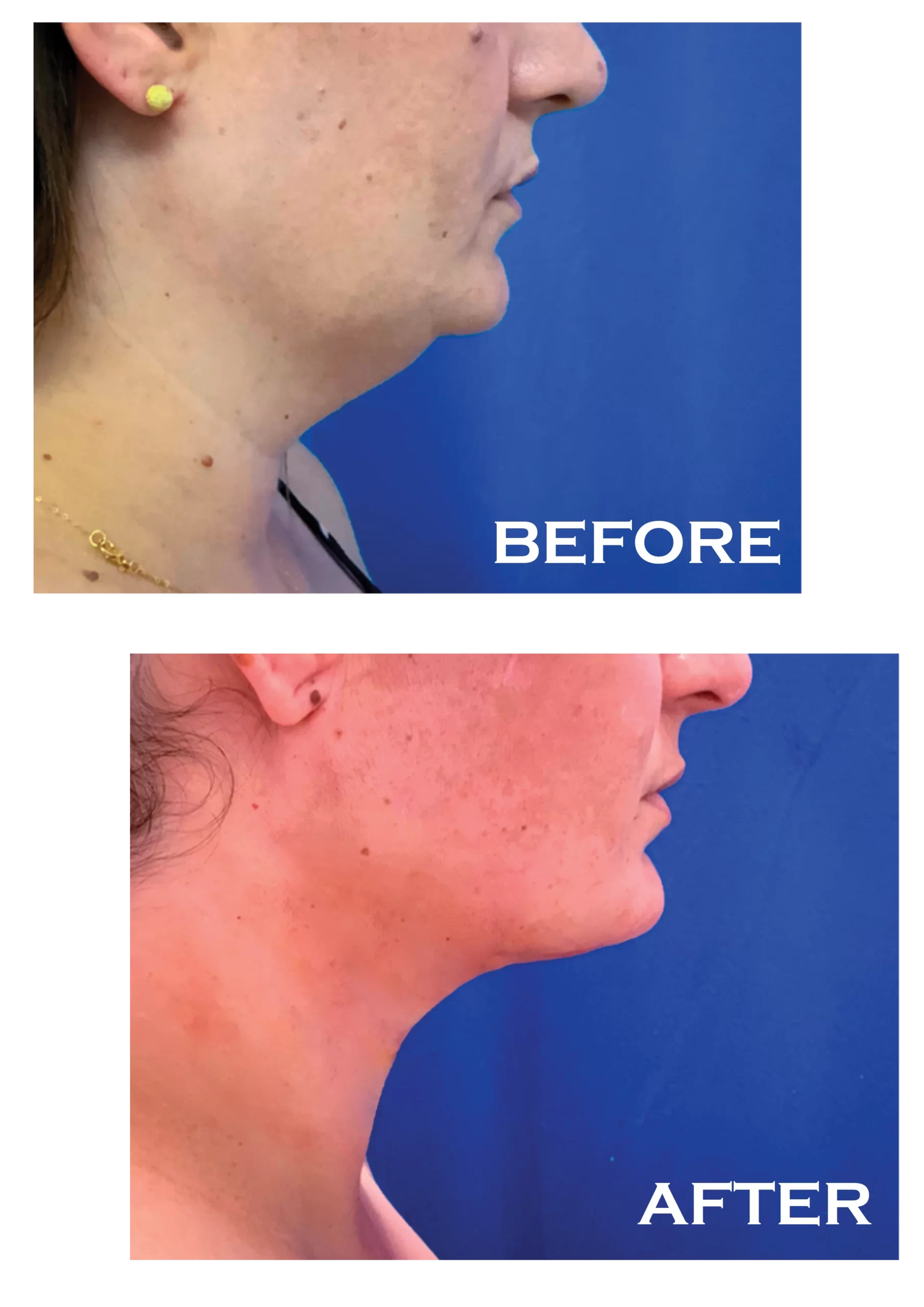 illustration suggesting the performance of facial surgeries