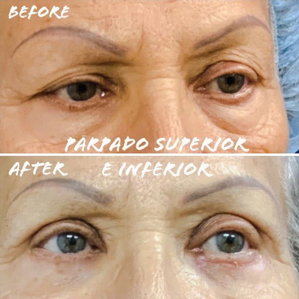 illustration suggesting the performance of facial surgeries