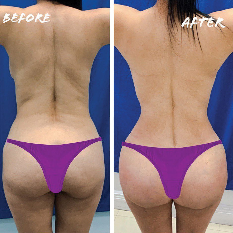 illustration suggesting the performance of facial surgeries