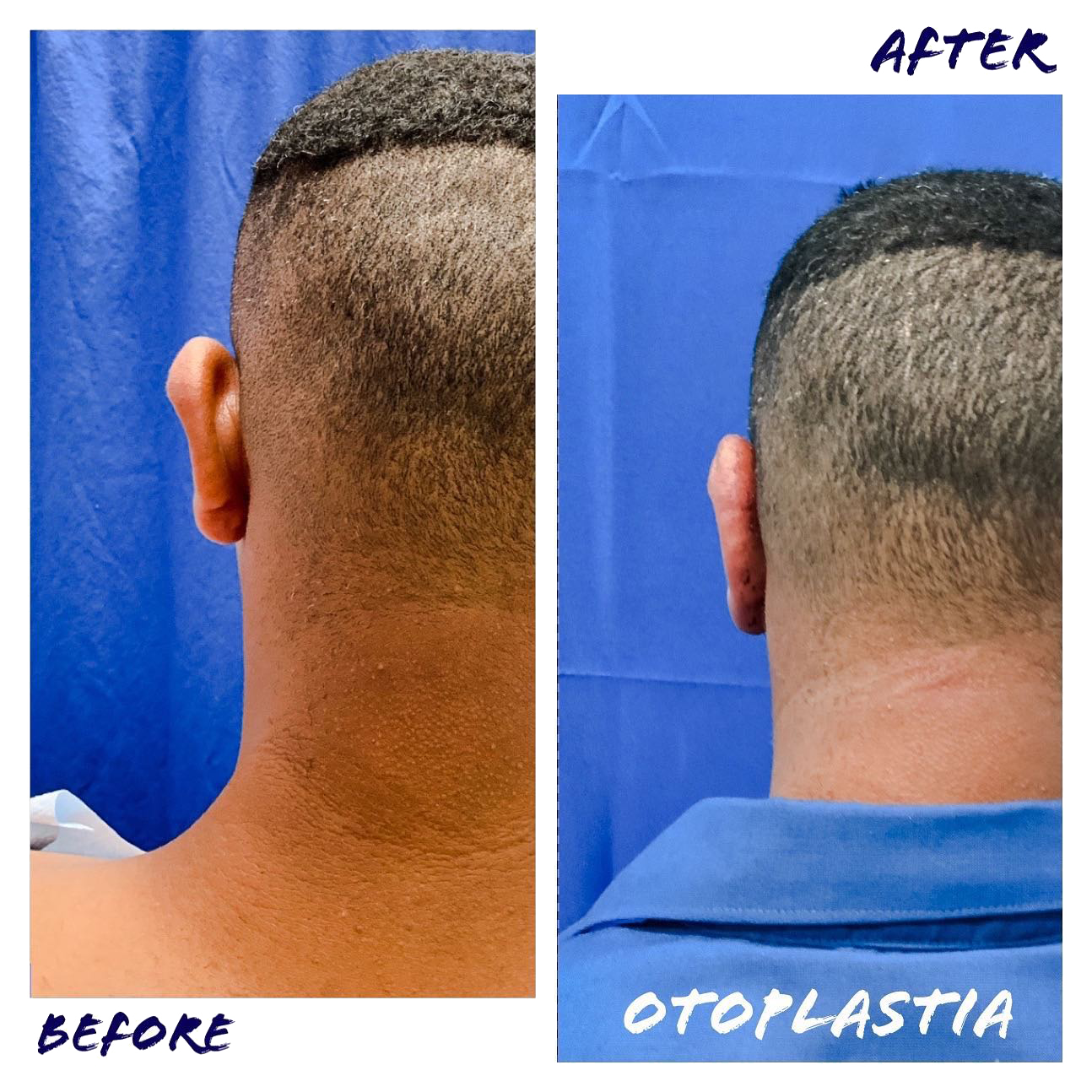 illustration suggesting the performance of facial surgeries