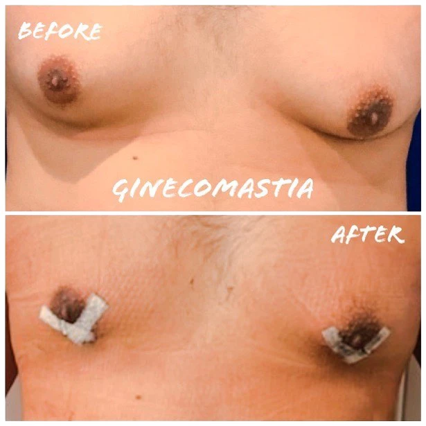 illustration suggesting the performance of facial surgeries