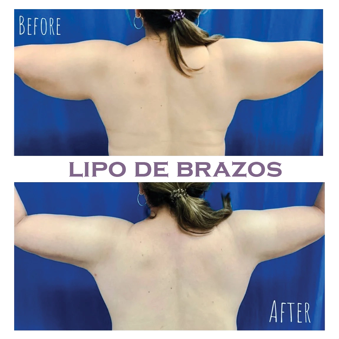 illustration suggesting the performance of facial surgeries