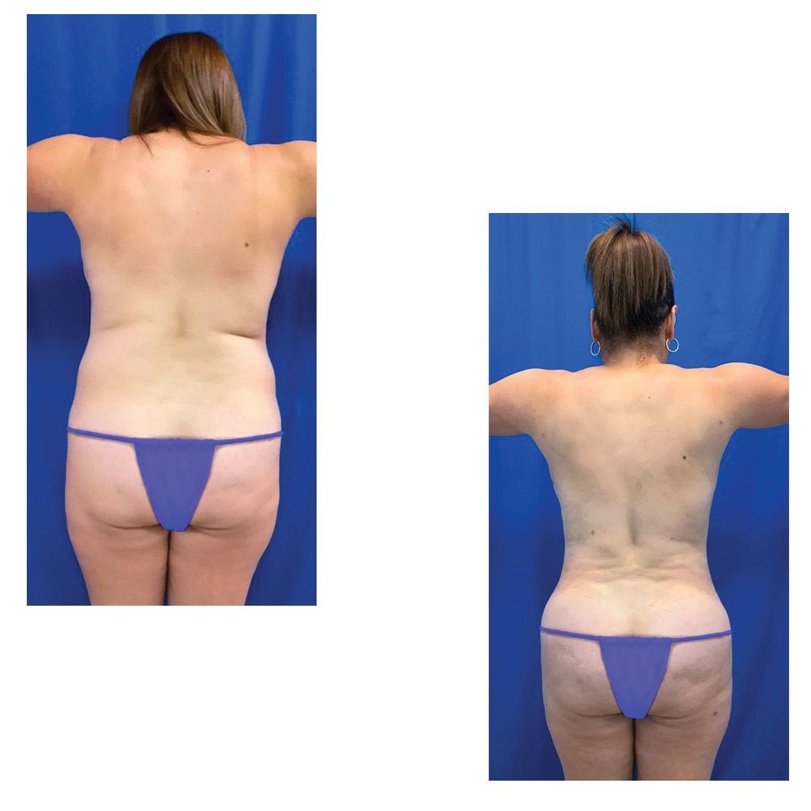 illustration suggesting the performance of facial surgeries