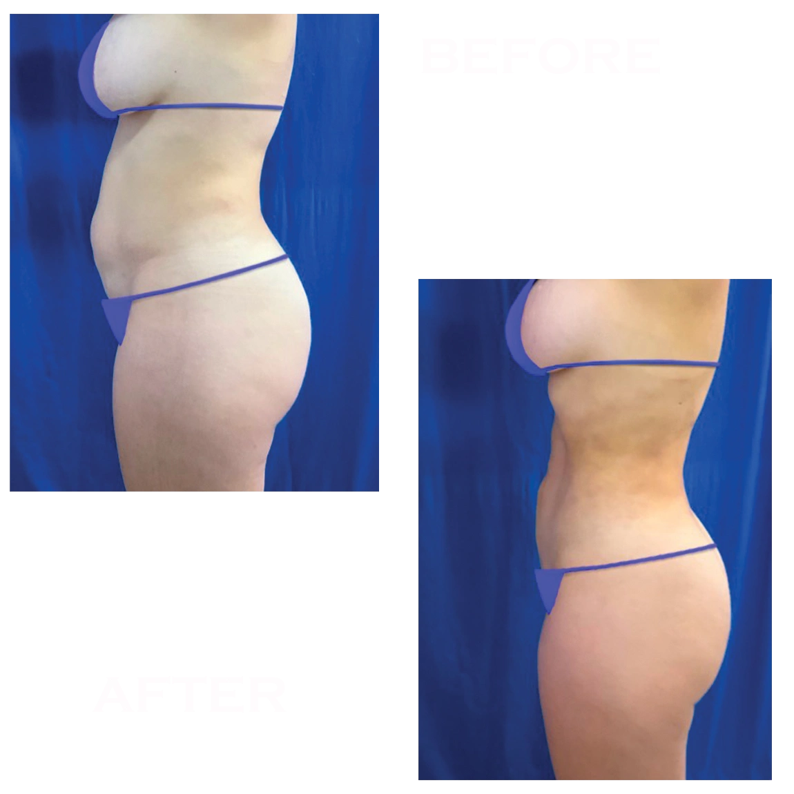 illustration suggesting the performance of facial surgeries