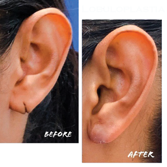 illustration suggesting the performance of facial surgeries