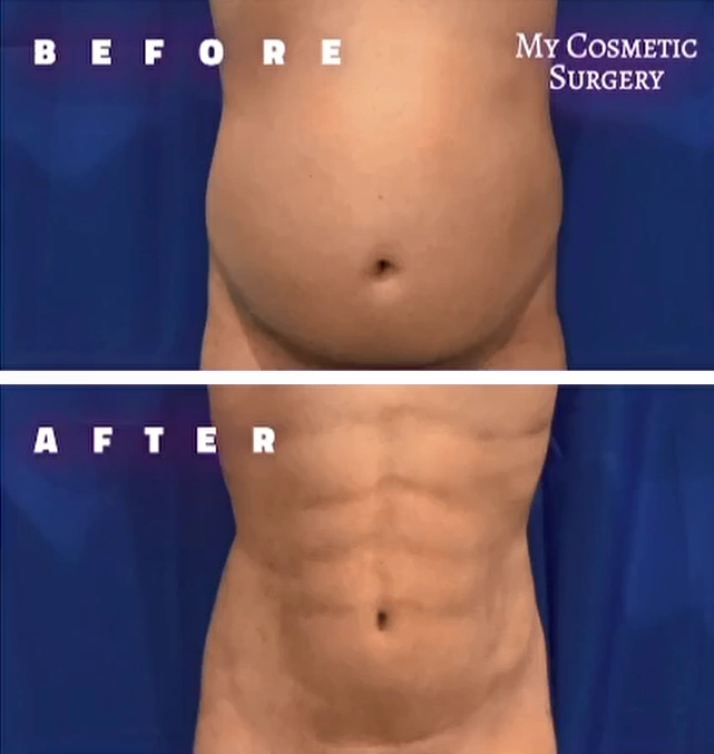 illustration suggesting the performance of facial surgeries